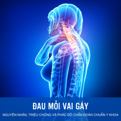 ĐAU MỎI VAI GÁY: NGUYÊN NHÂN, TRIỆU CHỨNG VÀ PHÁC ĐỒ CHẨN ĐOÁN CHUẨN Y KHOA