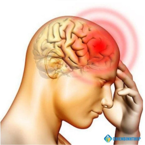 Đau Nửa Đầu Bên Phải Có Nguy Hiểm? Dấu Hiệu Cần Nhập Viện Gấp