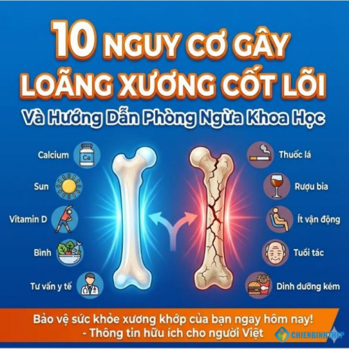 10 Nguy Cơ Gây Loãng Xương Cốt Lõi Và Hướng Dẫn Phòng Ngừa Khoa Học
