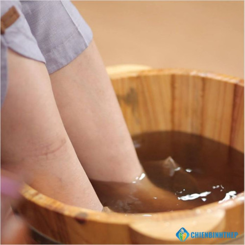 Người bị Suy Giãn Tĩnh Mạch ngâm chân thế nào cho an toàn? 3 Quy tắc vàng