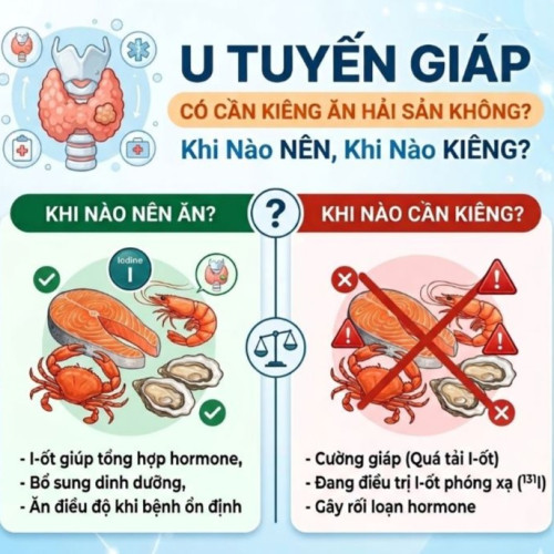 U Tuyến Giáp có cần kiêng ăn hải sản không? Khi Nào NÊN, Khi Nào KIÊNG?