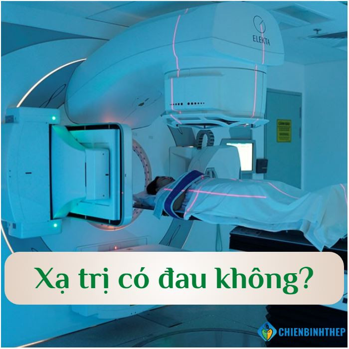 Xạ Trị Có Đau Không? Lời Giải Đáp Tận Tình Và Cẩm Nang Giúp Bạn Nhẹ Nhàng Vượt Qua