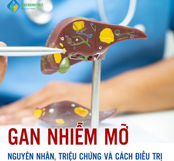 Gan Nhiễm Mỡ: Hiểu Đúng, Sống Khỏe