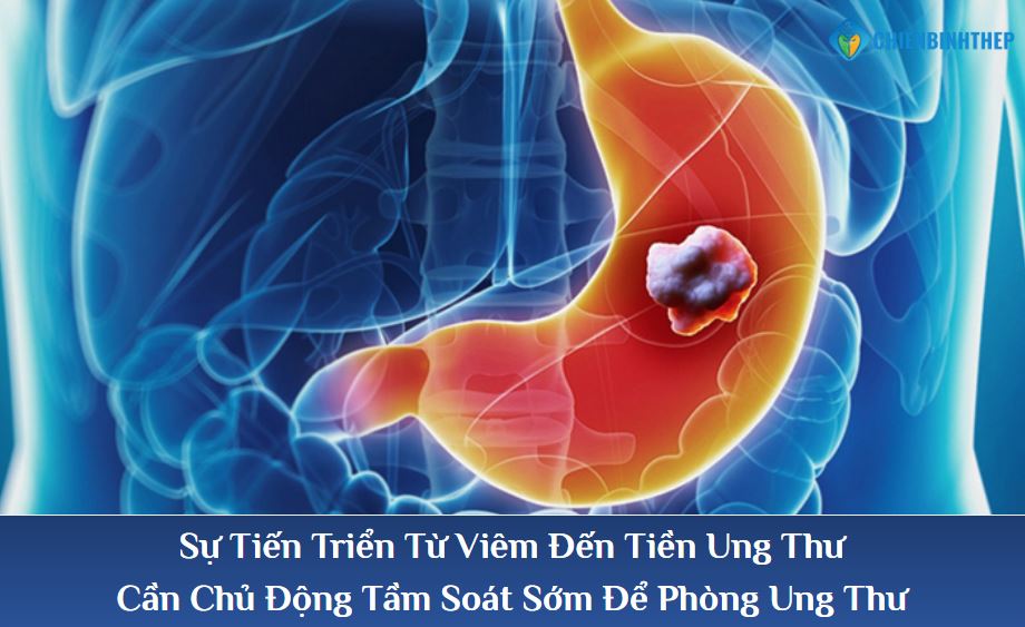 Sự tiến triển từ viêm đến tiền ung thư
