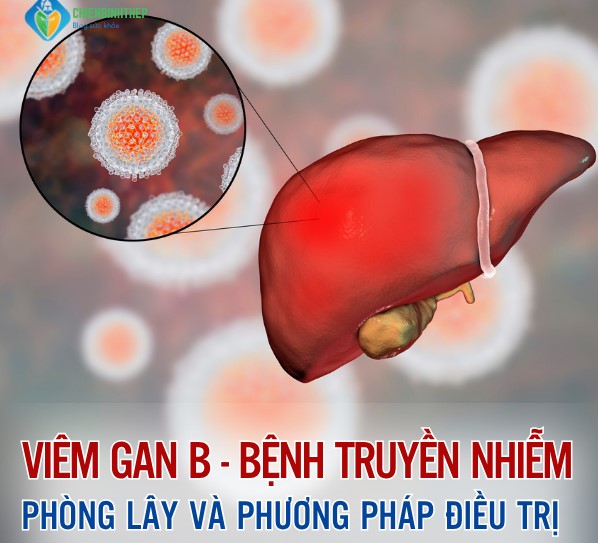 Viêm gan B Bệnh truyền nhiễm