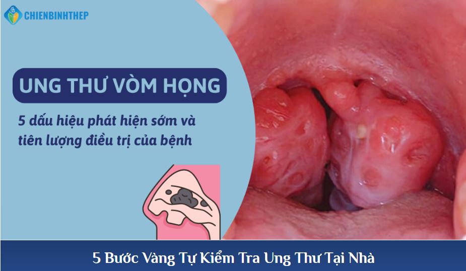 5 Bước Vàng Tự Kiểm Tra Tại Nhà
