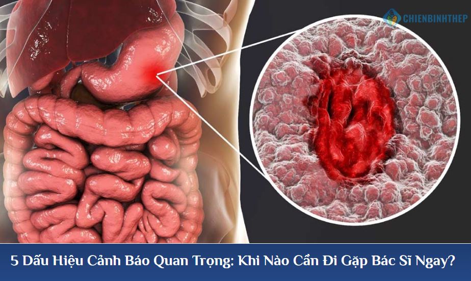5 Dấu hiệu cảnh báo ung thư dạ dày