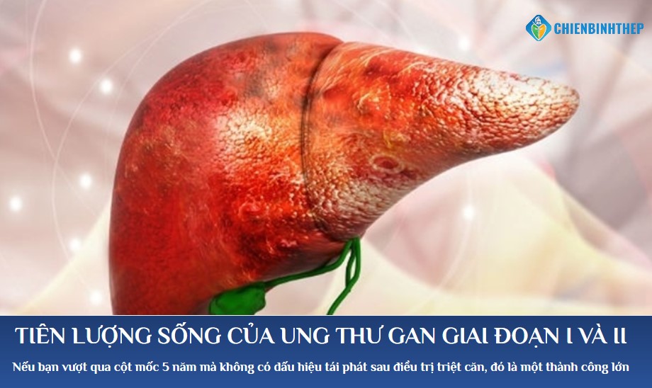 Tiên lượng ung thư gan giai đoạn 1 và 2