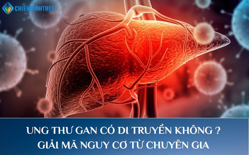 Ung Thư Gan Có Di Truyền Không? Giải Mã Nguy Cơ Từ Chuyên Gia