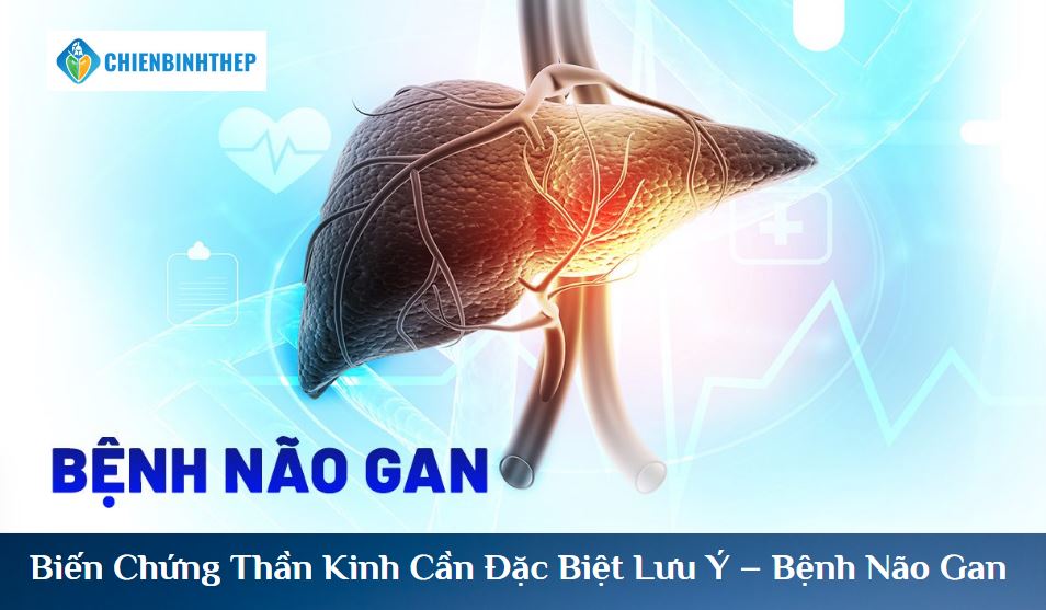 Biến Chứng Thần Kinh Cần Đặc Biệt Lưu Ý – Bệnh Não Gan