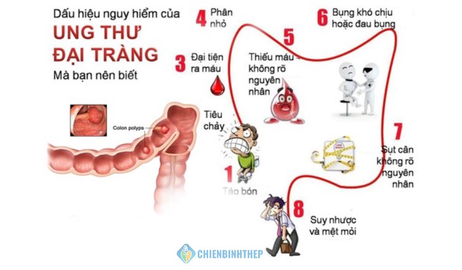 Dấu hiệu ung thư trực tràng