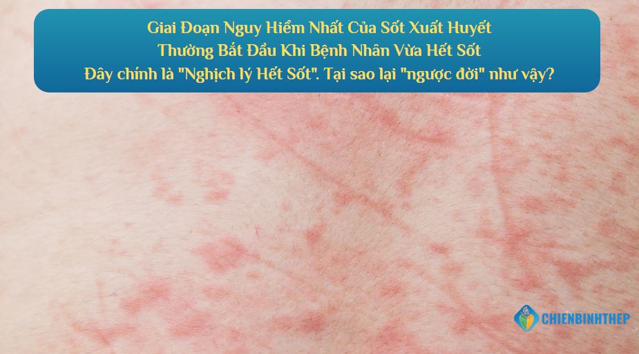 Giai đoạn nguy hiểm nhất của sốt xuất huyết