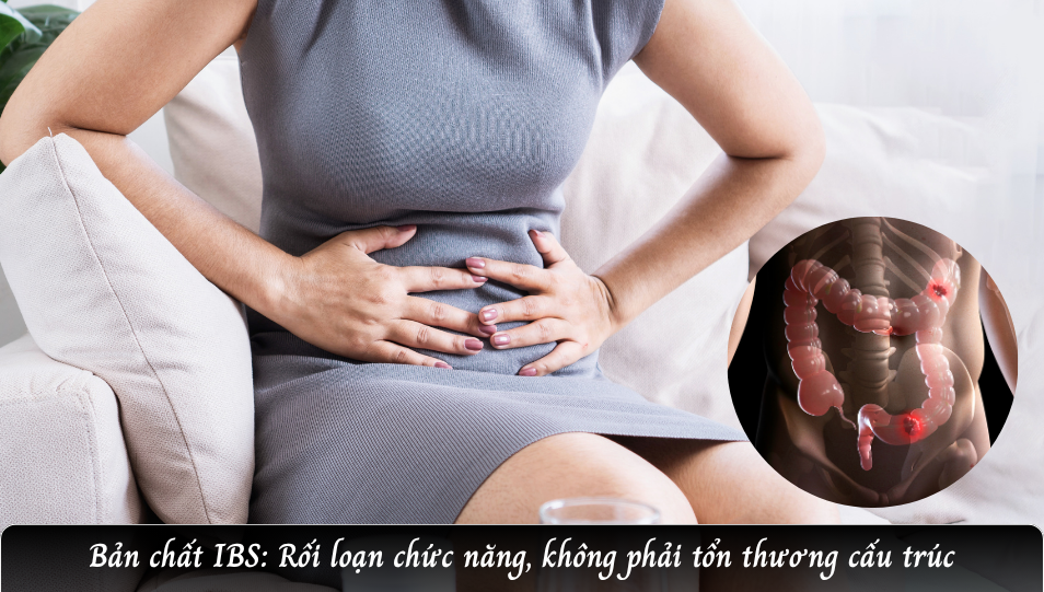 Bản chất IBS: Rối loạn chức năng, không phải tổn thương cấu trúc
