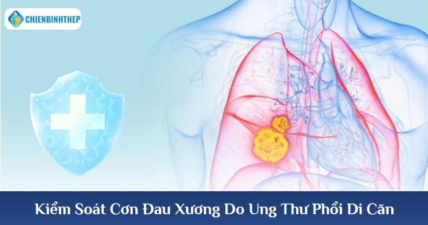 Kiểm Soát Cơn Đau Toàn Diện