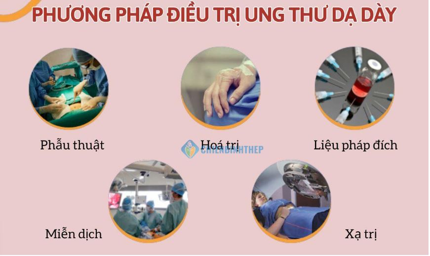 Phương pháp điều trị ung thư dạ dày
