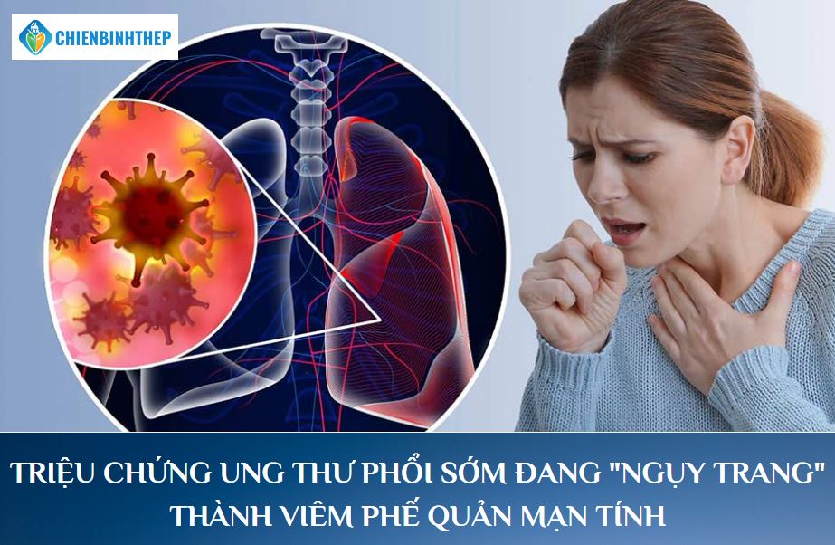 Ung thư phổi gây ho dai dẳng trên 3 tuần
