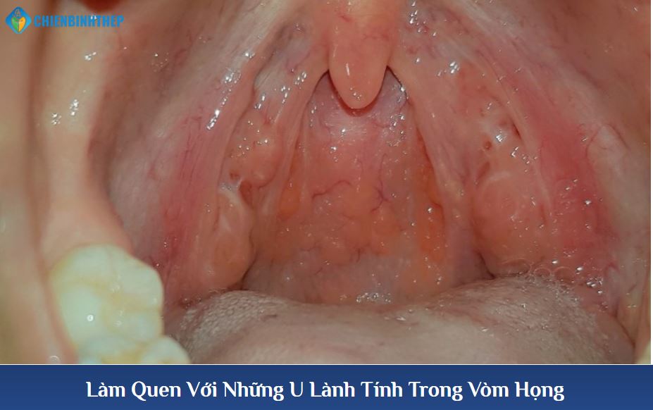 Làm Quen Với Những 