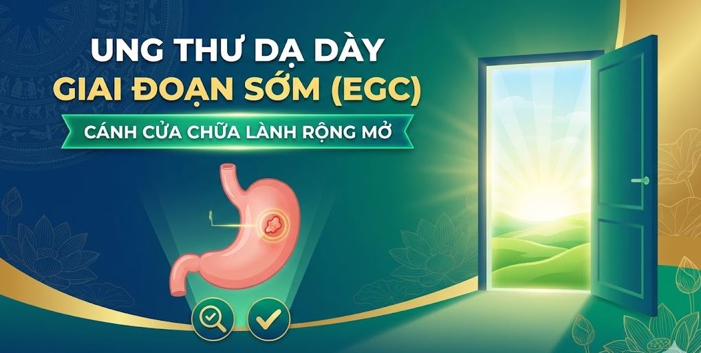 Ung thư dạ dày giai đoạn sớm