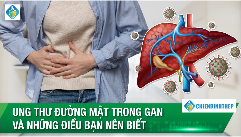 Ung thư đường mật trong gan và những điều cần biết