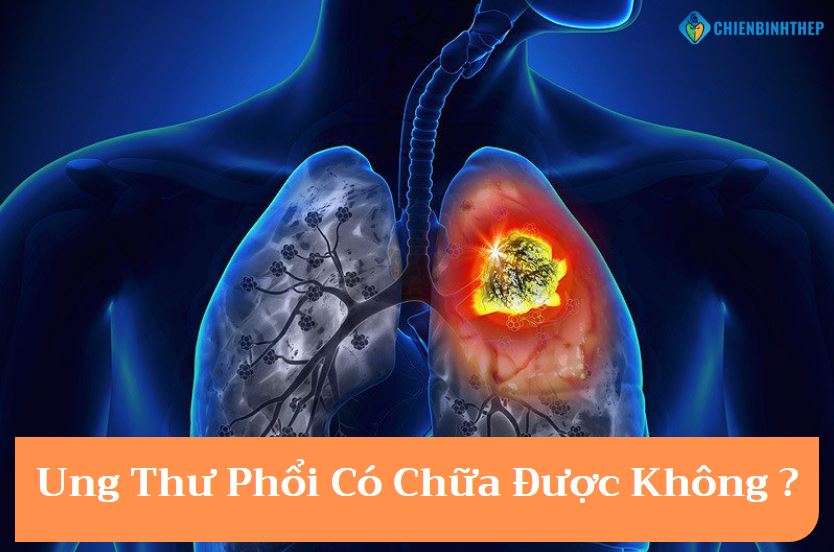 Ung thư phổi có chữa được không