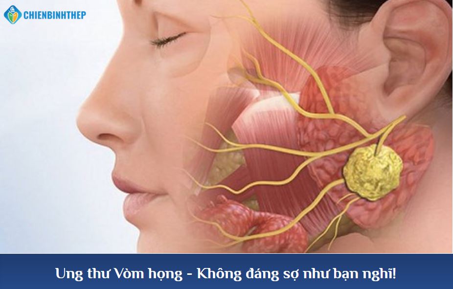 Hiểu về Ung thư Vòm họng - Không đáng sợ như bạn nghĩ